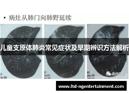 儿童支原体肺炎常见症状及早期辨识方法解析